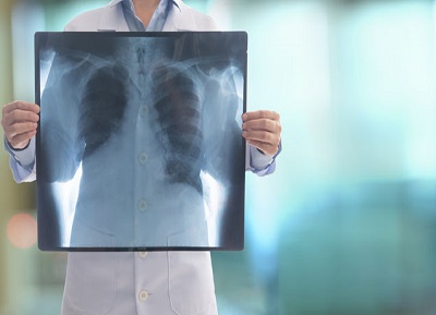 Medical Radiography